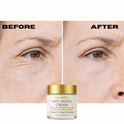 [Buy 1 Get 1 Free] Anti-Aging Cream